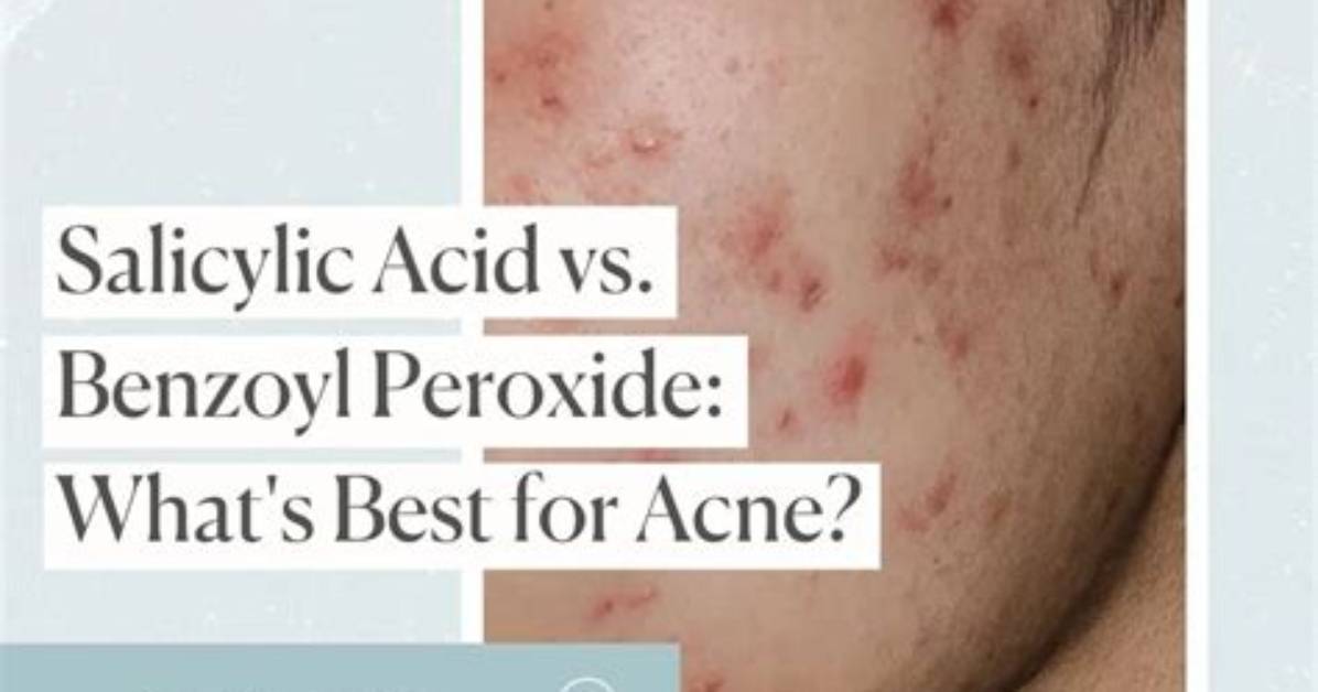 Benzoyl Peroxide Vs. Antibacterial Soap: Dermatologists Settle the Armpit Odor Debate