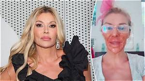 Brandi Glanville Nair Burn Incident: Timeline of the Reality Star’s Viral Video Revelation