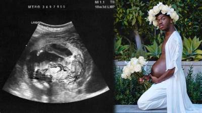 Fact-Checking Lil Nas X's Pregnancy Stunt: Viral Prank or Boundary-Pushing Art?