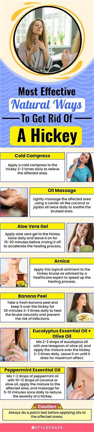 How to Get Rid of a Hickey Fast: Proven Home Remedies and Concealing Tricks