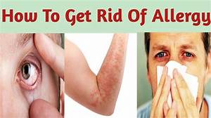 How to Get Rid of an Allergic Reaction on Your Face Fast: Expert Sos Guide