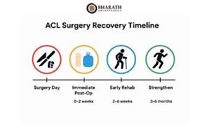 Lacy Acl Injury Explained: Recovery Timeline, Surgery, and Career Outlook
