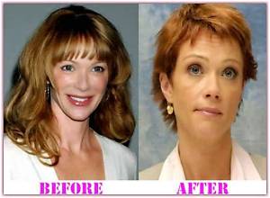 Lauren Holly Plastic Surgery Faq: Answers to Fans' Most Searched Questions