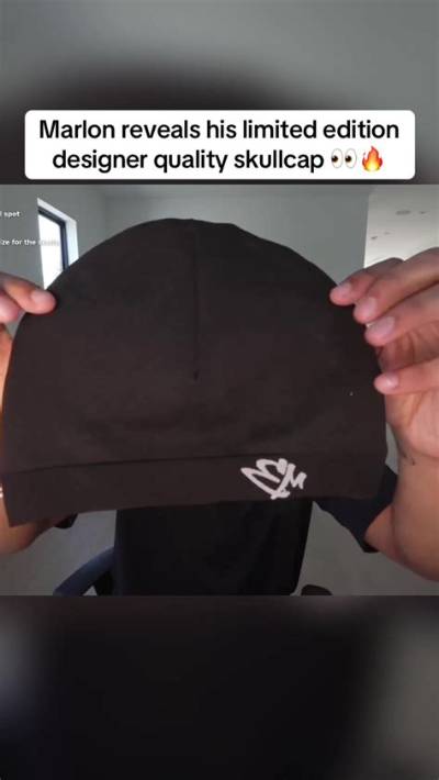 Spotting the Marlon Skull Cap: Visual Breakdown and Authentic Style Comparison