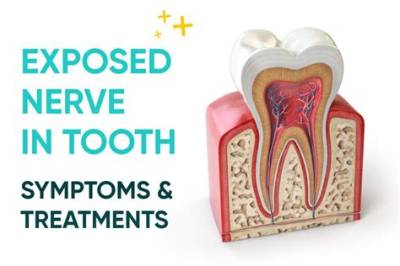 The Rise of the Exposed Nerve Trend: How a Bizarre Web Gag Became a Mainstream Obsession