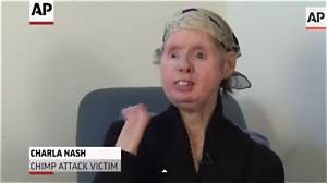 Unpacking the Charla Nash Dispatch Audio: Verified Transcripts and Emergency Records