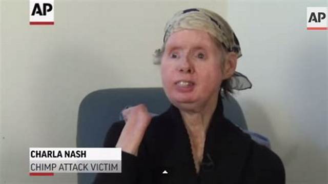 Unpacking the Charla Nash Dispatch Audio: Verified Transcripts and Emergency Records